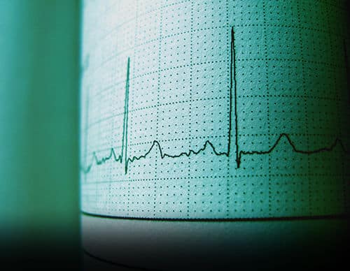 analysis-cardiogram-diagnosis-1093161 2